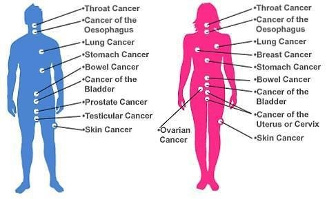 Exploring the Diversity of Cancers: A Comprehensive Guide to Various Types